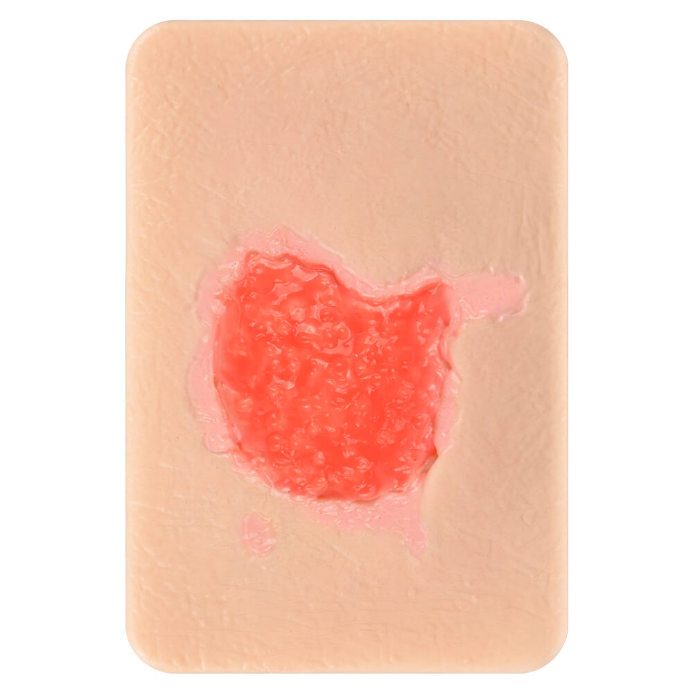 Granulation Tissue Wound Simulation Models Set