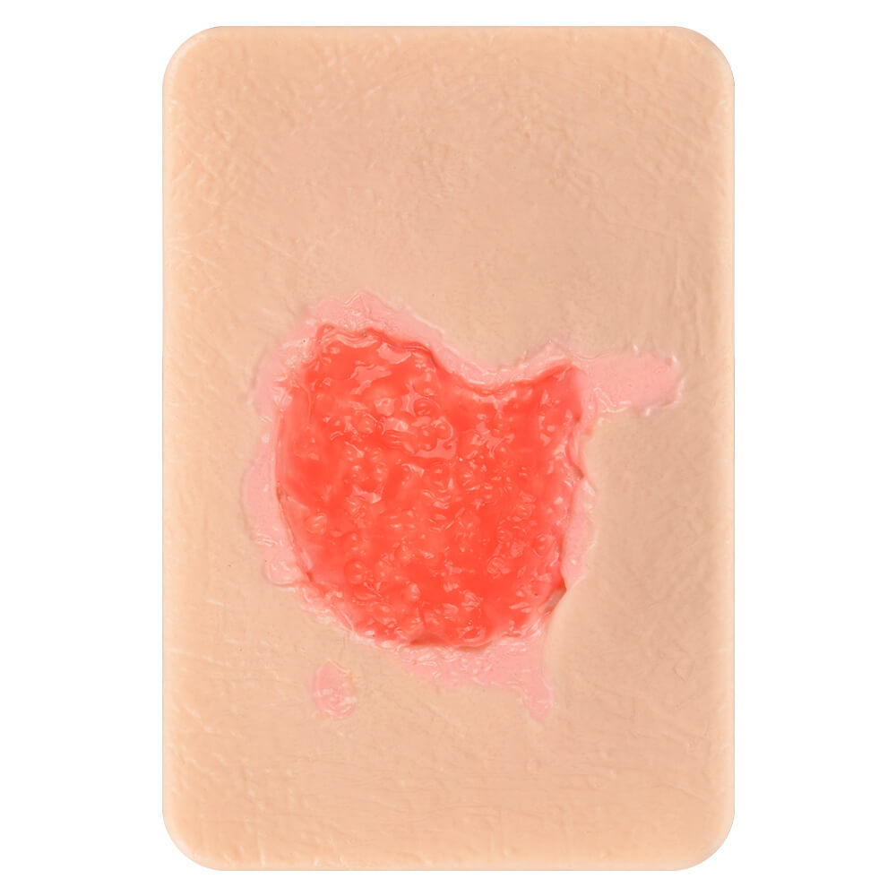 Granulation Tissue Wound Simulation Models Set