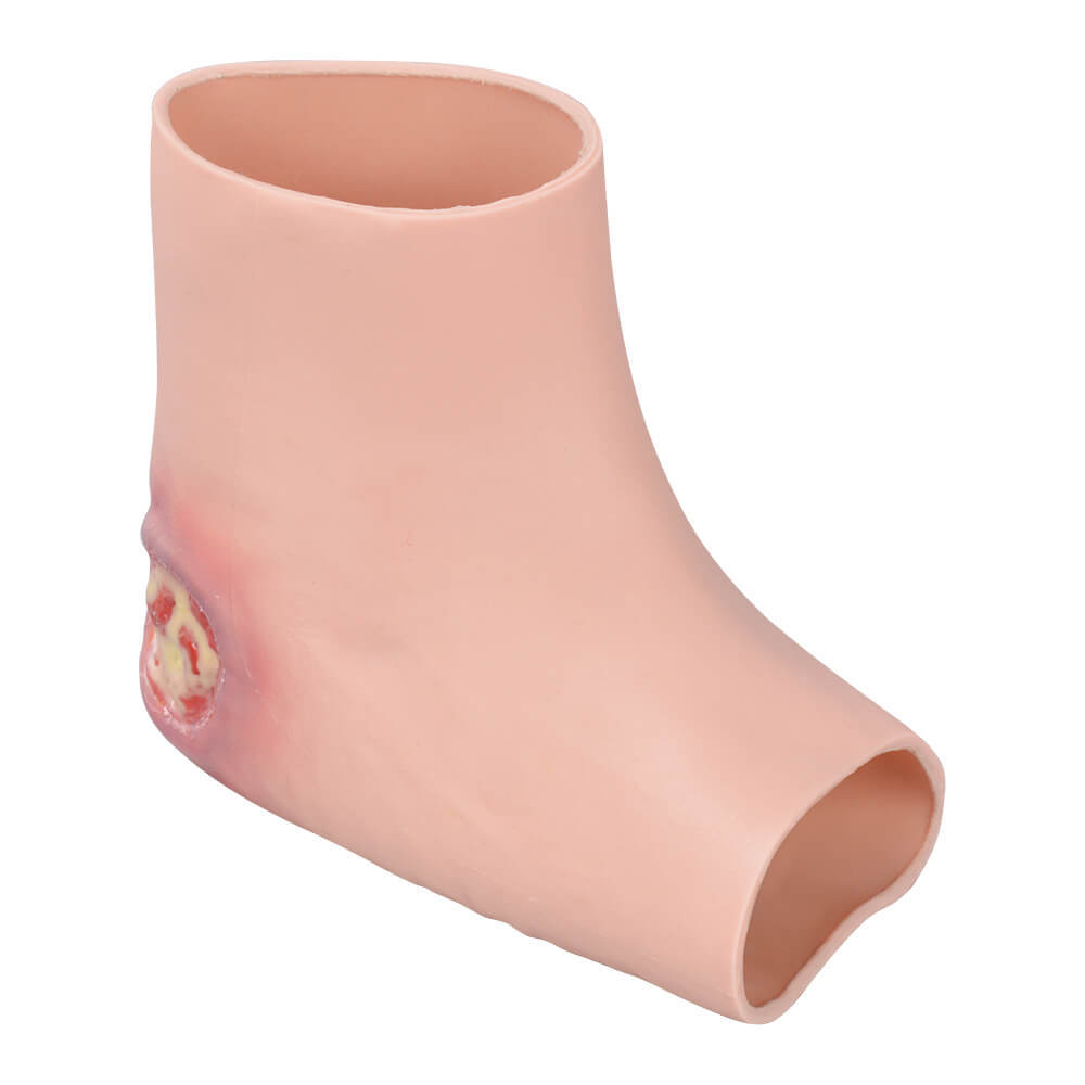 Heel Pressure Ulcer Nursing Training Model (Wearable Sock-Style)