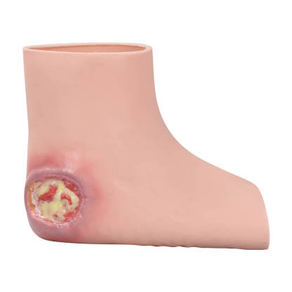Heel Pressure Ulcer Nursing Training Model (Wearable Sock-Style)