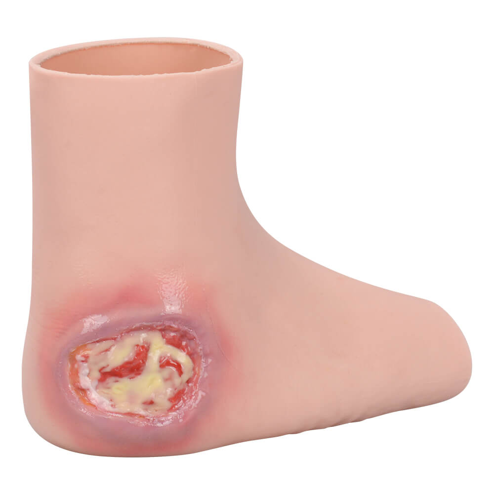 Heel Pressure Ulcer Nursing Training Model (Wearable Sock-Style)