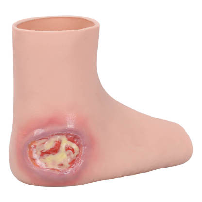 Heel Pressure Ulcer Nursing Training Model (Wearable Sock-Style)