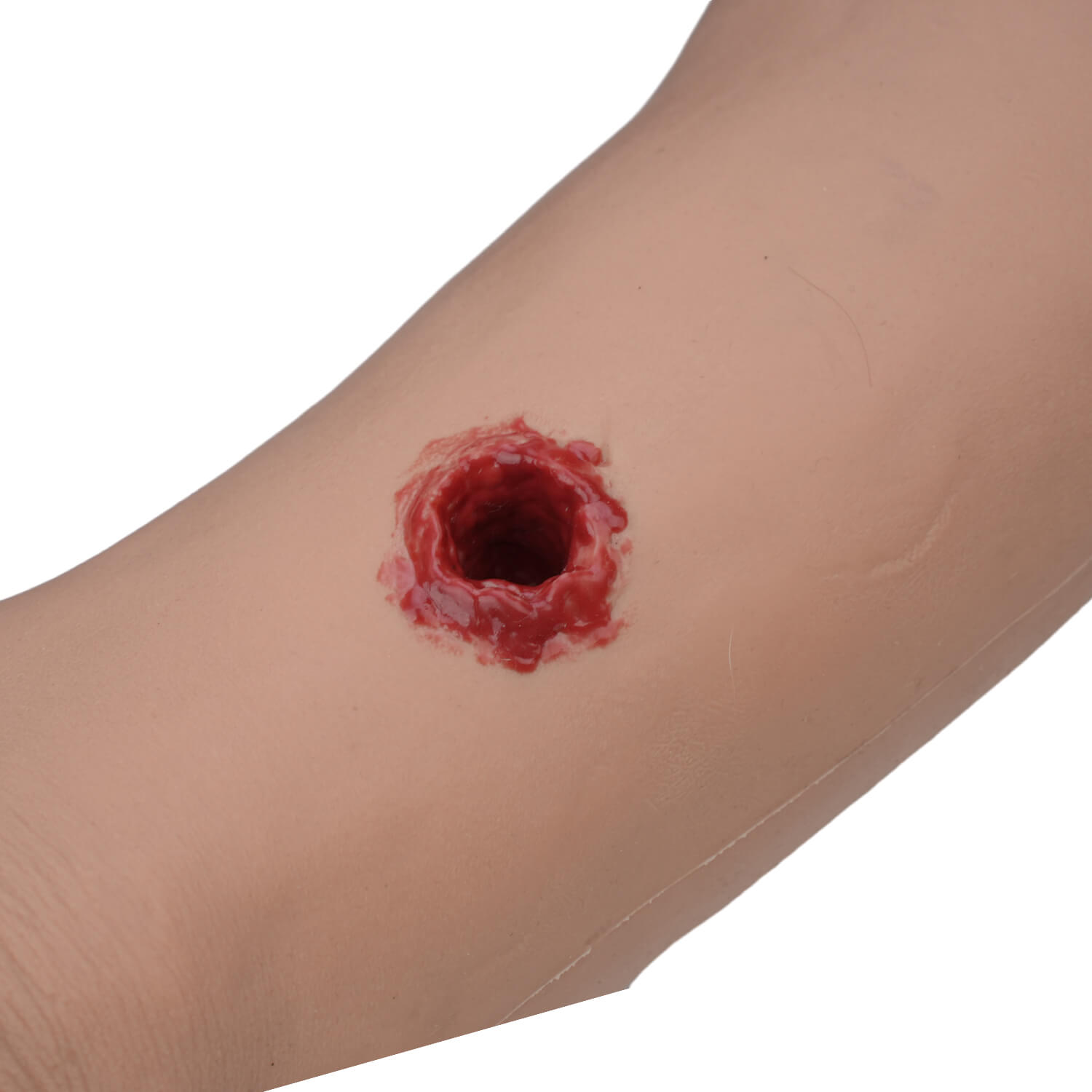 Ultrassist Multi-Wound Hemorrhage Control Arm with Gunshot Wounds