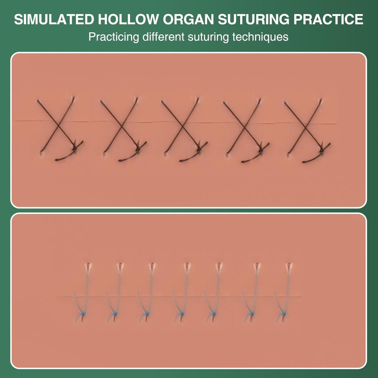 Ultrassist Hollow Organ Suturing Kit for Medical Training
