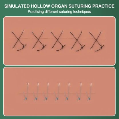 Ultrassist Hollow Organ Suturing Kit for Medical Training