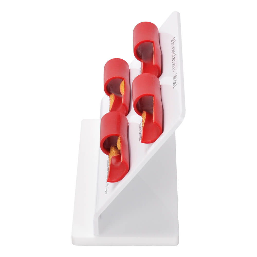 Human Atherosclerosis Artery Model - 4-Stage Plaque Progression