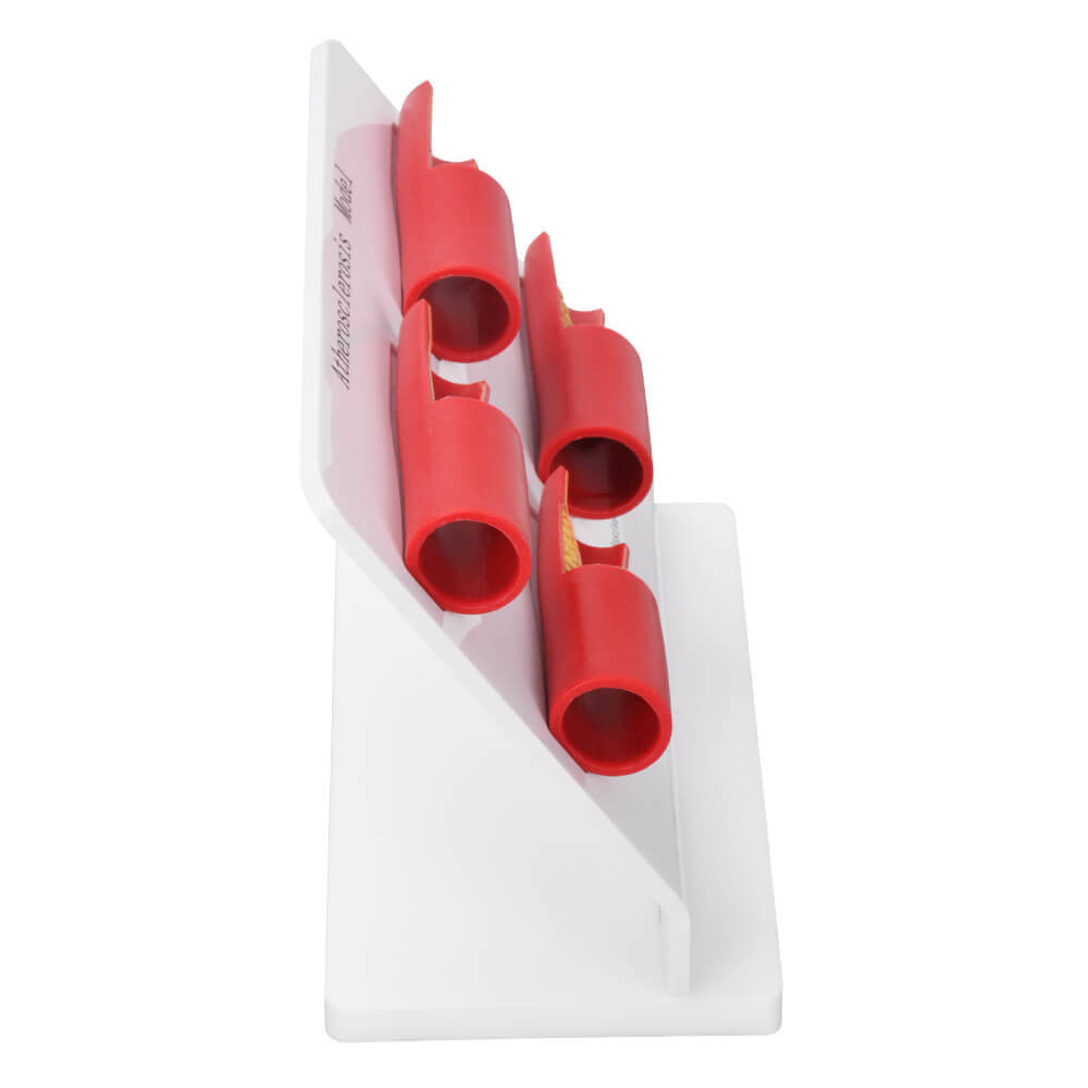 4-Stage Human Atherosclerosis Artery Model for Teaching & Demonstration