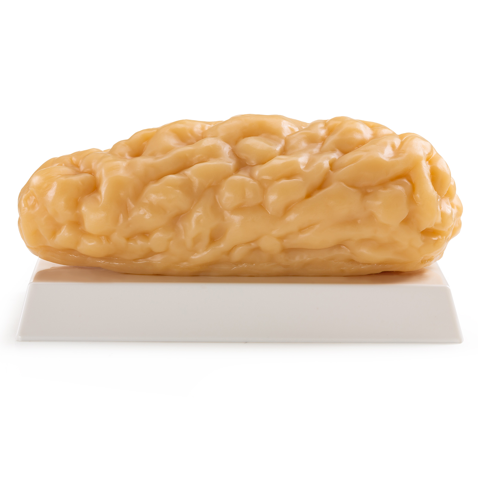 Ultrassist Human Body Fat Model (1, 2.5 & 5 lb) – Lifelike Fat Replicas for Fitness Training