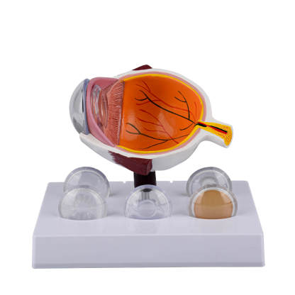 Ultrassist Human Cataract Eye Model for Medical Education