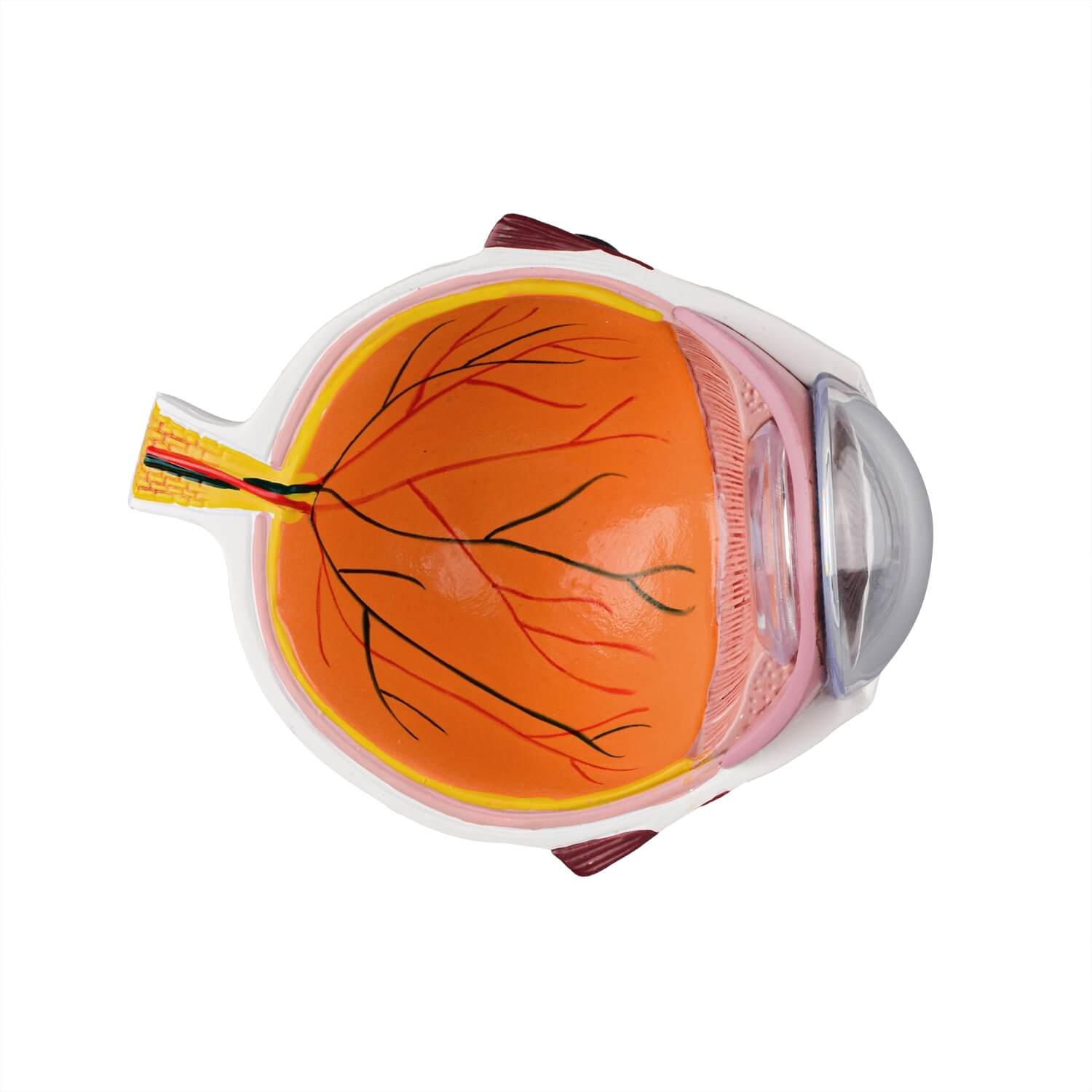 Ultrassist Human Cataract Eye Model for Medical Education