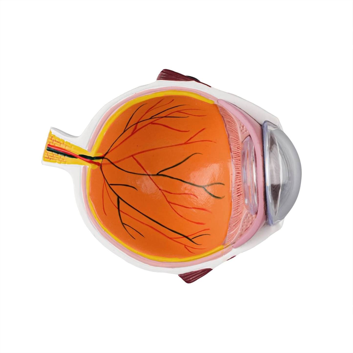 Ultrassist Human Cataract Eye Model for Medical Education