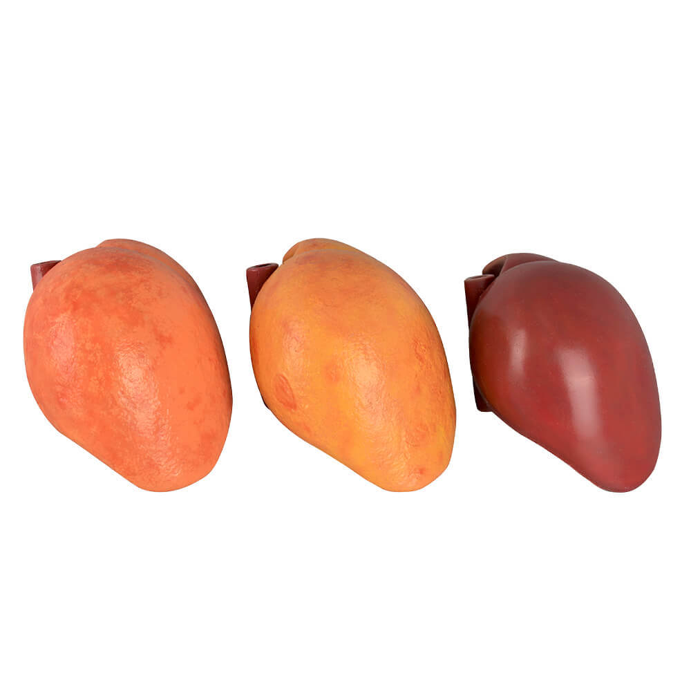 Normal & Fatty Liver Model Set with Gall Bladder