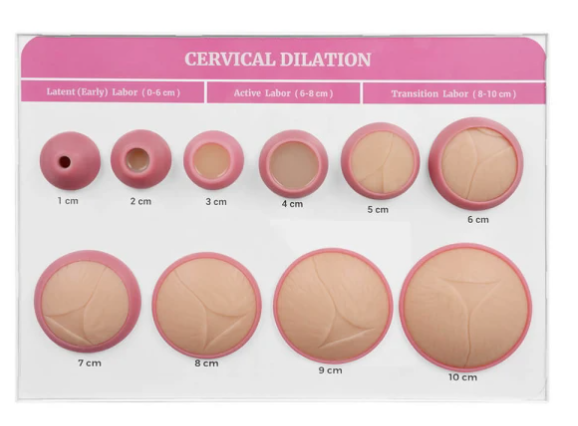 Cervical Dilatation and Effacement Models(10) with Easel Board Display