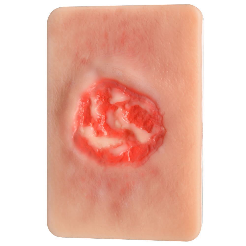 Stage III Pressure Ulcer Wound Simulation Model