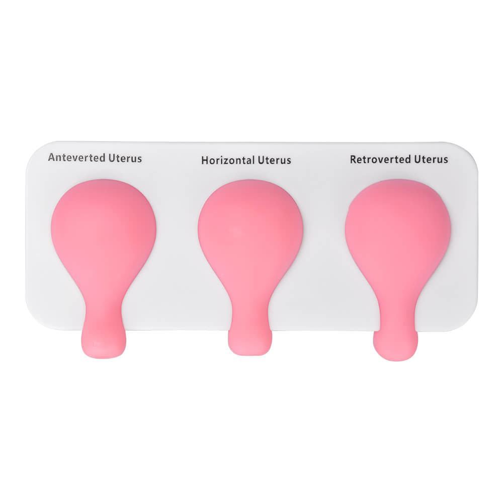 Dilatation and Curettage (D&C) Uterus Model 