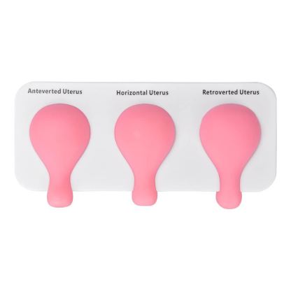 Dilatation and Curettage (D&C) Uterus Model 