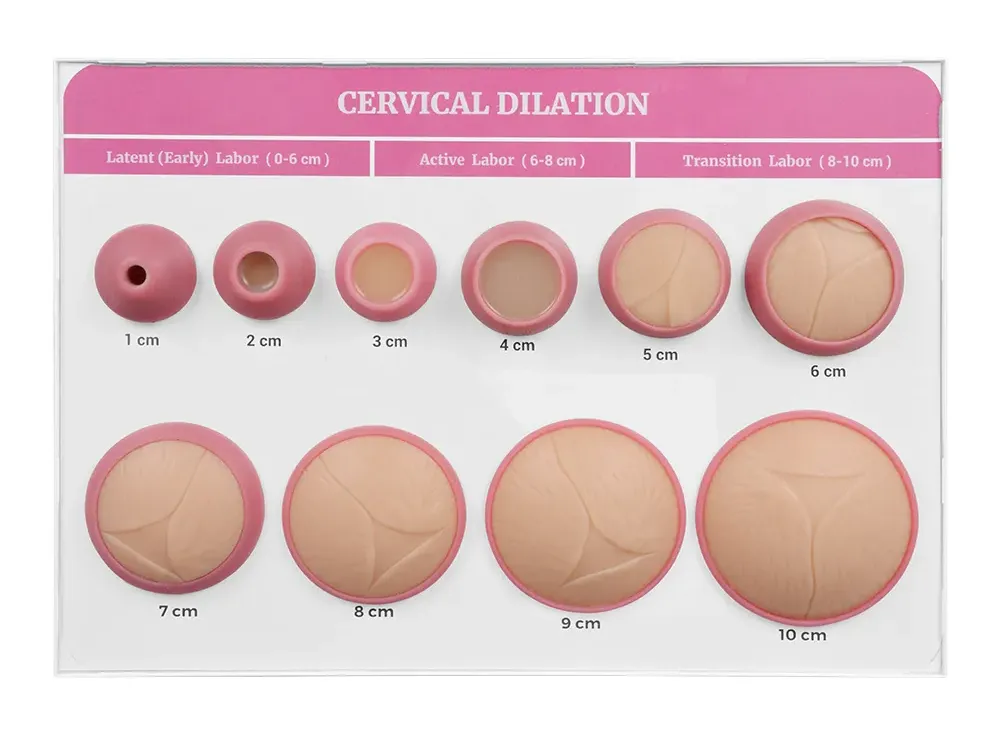 Cervical Dilatation and Effacement Models(10) with Easel Board Display