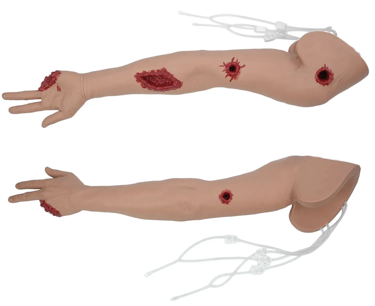 How to Treat Gunshot Wounds to the Arm and Hand