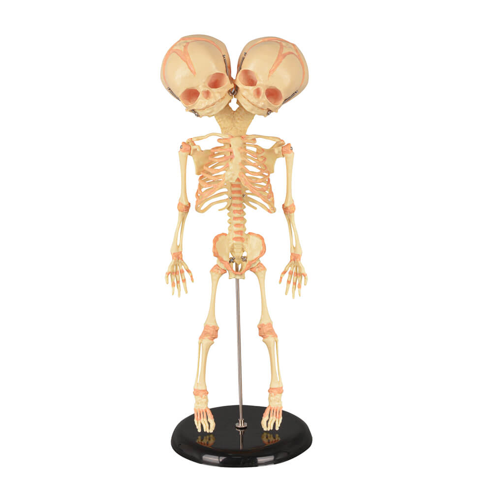 Infant Fetus Skeleton Model with Double Skull Head