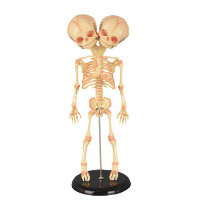 Infant Fetus Skeleton Model with Double Skull Head
