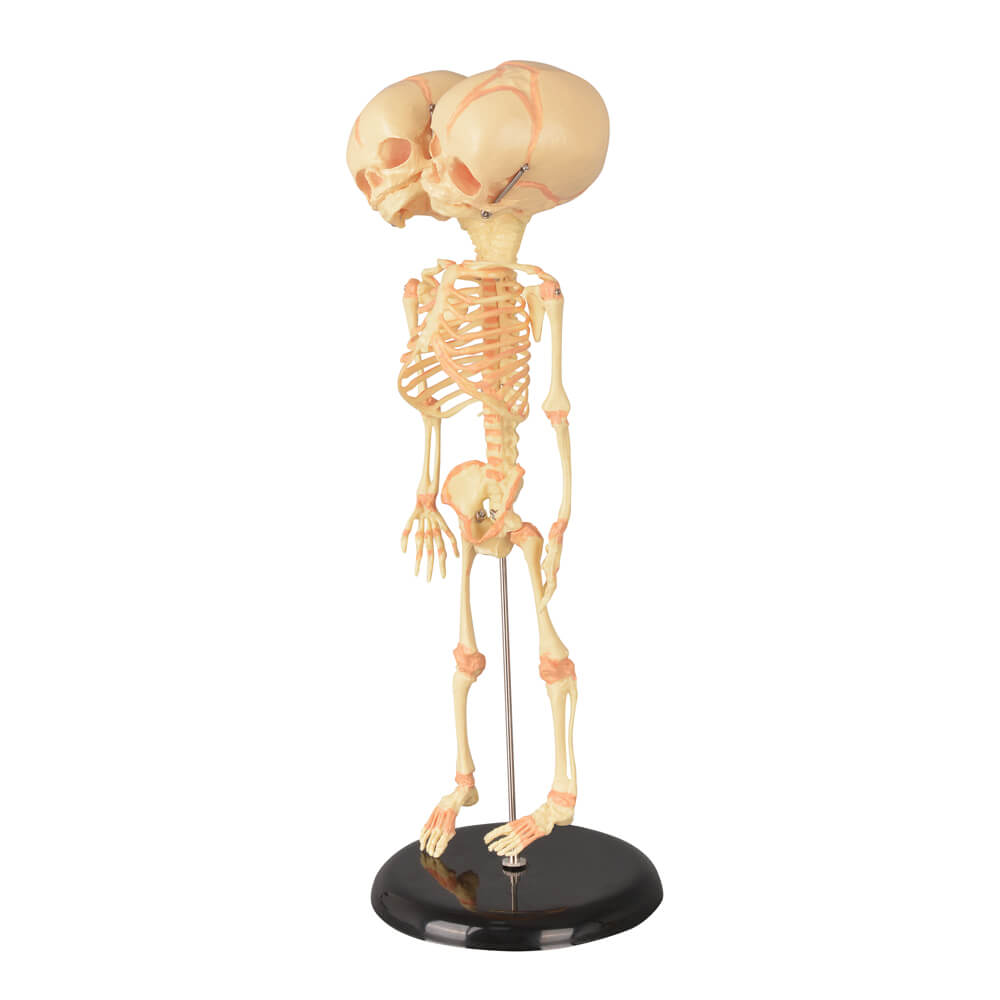 Infant Fetus Skeleton Model with Double Skull Head