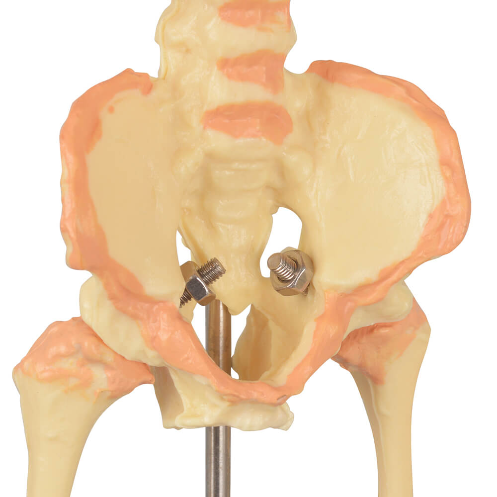 Infant Fetus Skeleton Model with Double Skull Head
