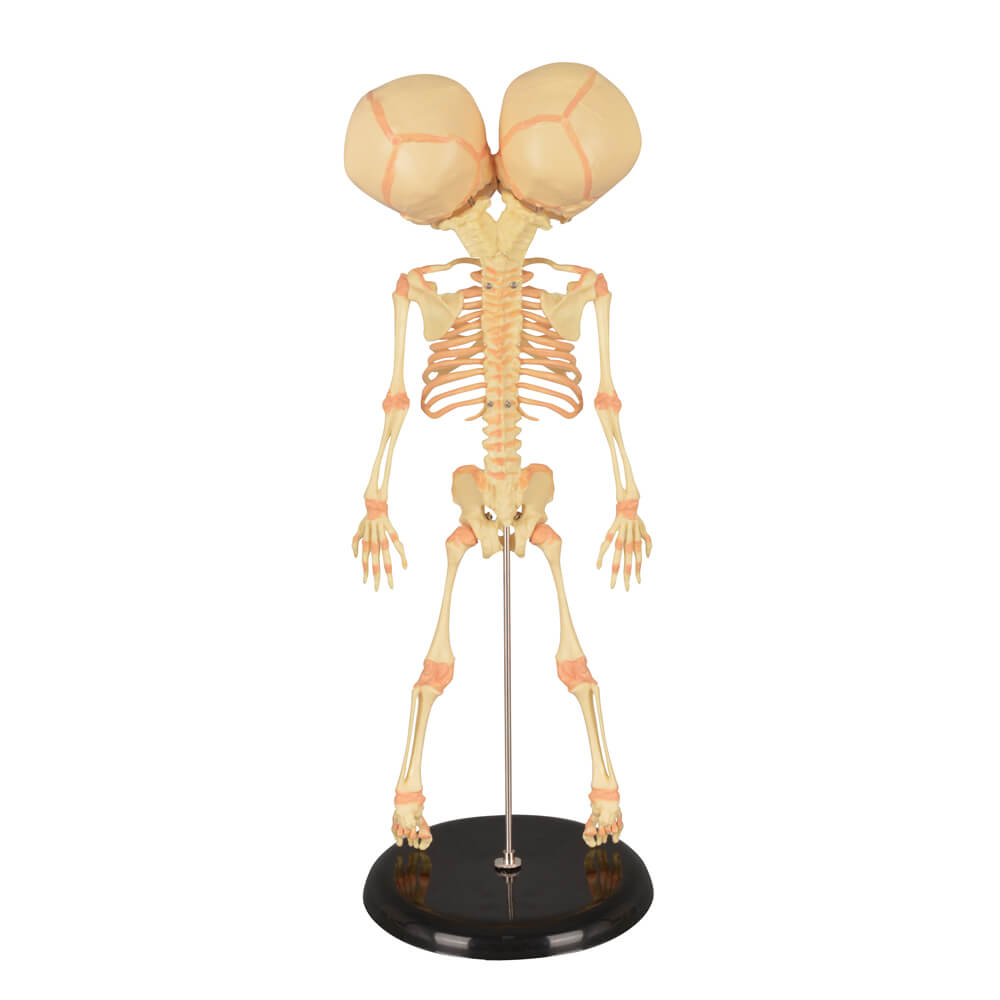 Infant Fetus Skeleton Model with Double Skull Head