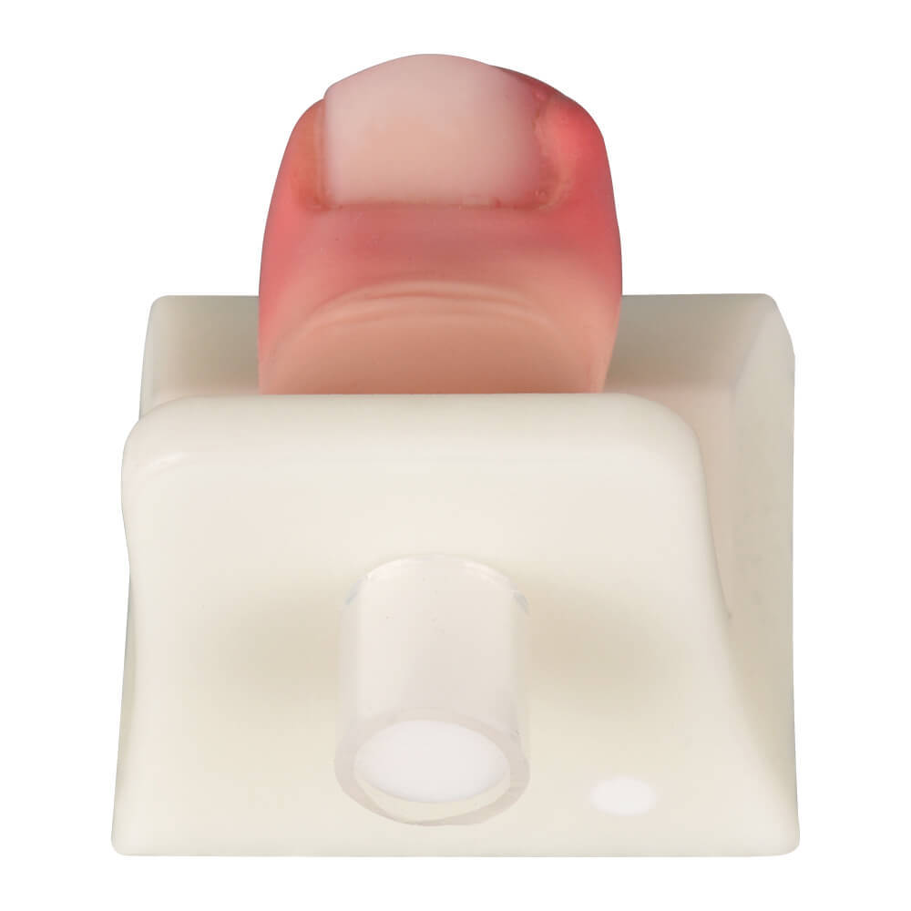 Ingrown Toenail Removal Trainer Model for Nail Avulsion Practice
