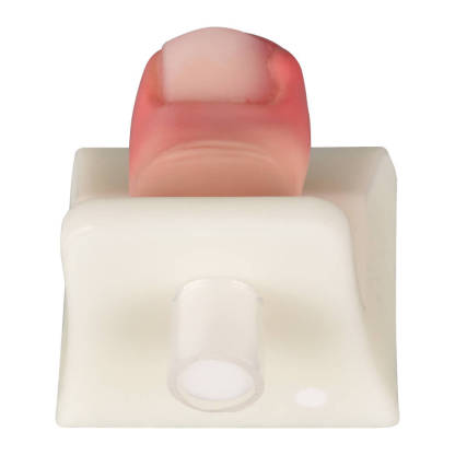 Ingrown Toenail Removal Trainer Model for Nail Avulsion Practice