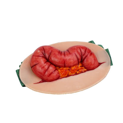 Wearable Abdominal Evisceration Intestinal Wound Simulator