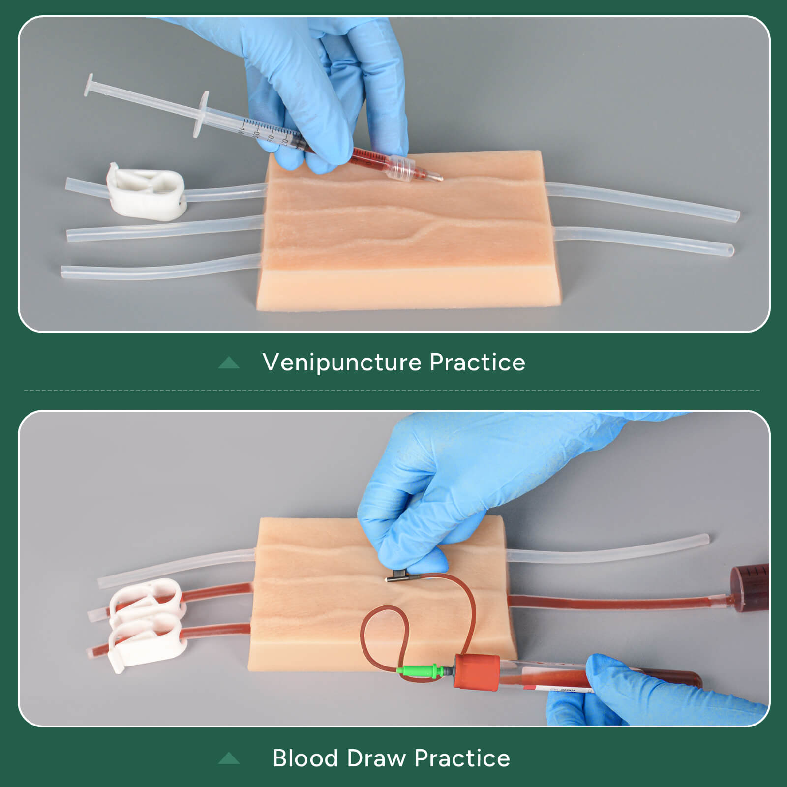 Ultrassist IV Injection Practice Kit for Venipuncture & IV Insertion Training