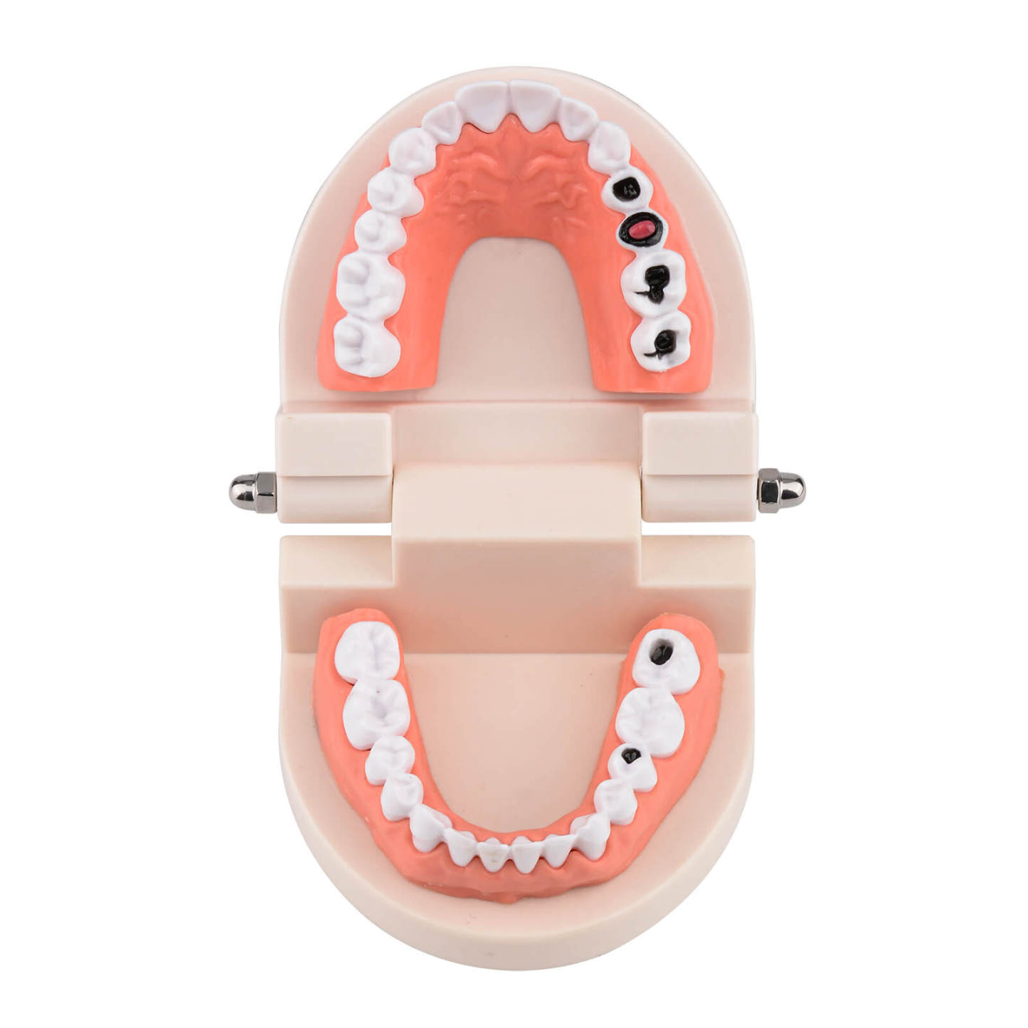 Life-Size Dental Caries Study Model with 28 Adult Teeth