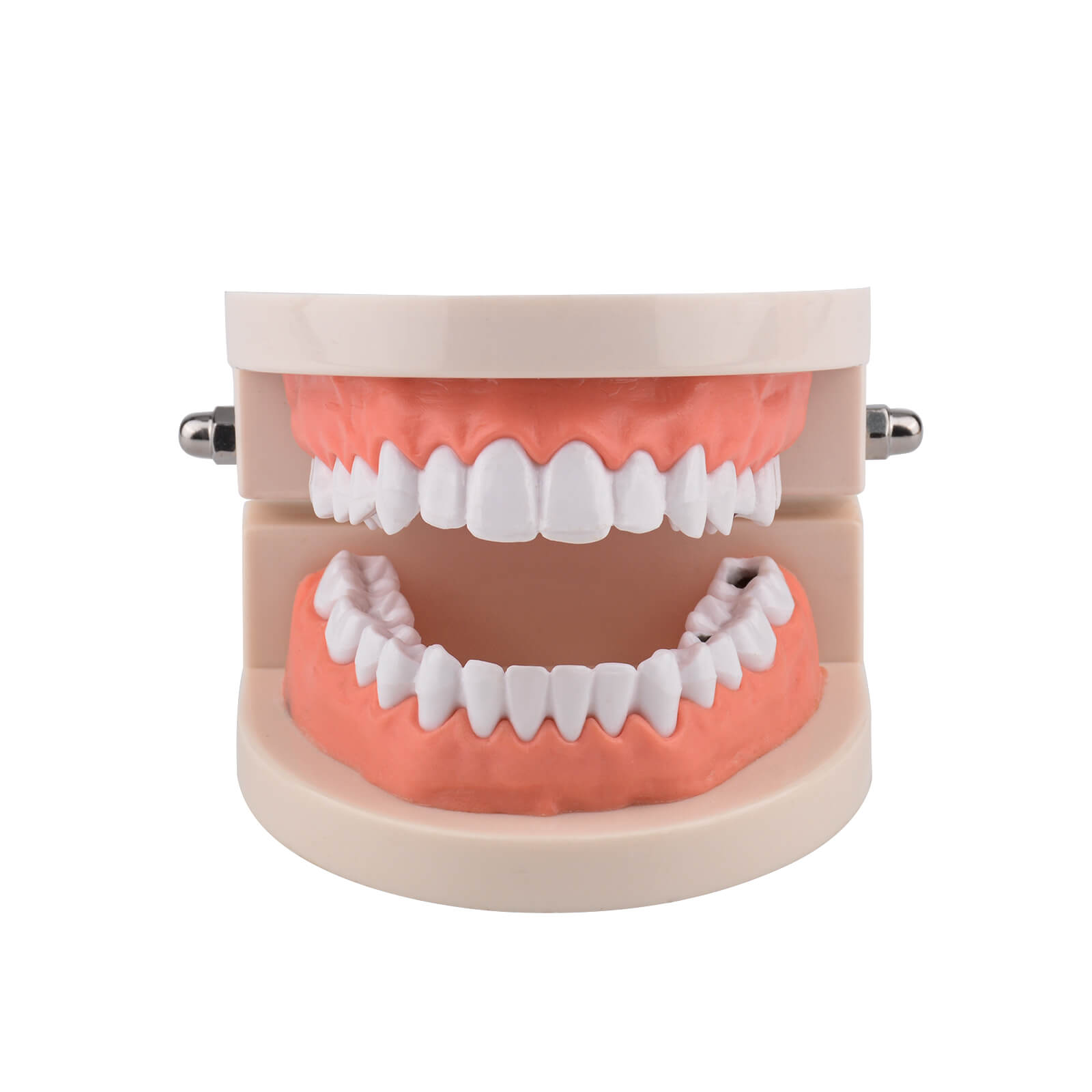 Life-Size Dental Caries Study Model with 28 Adult Teeth