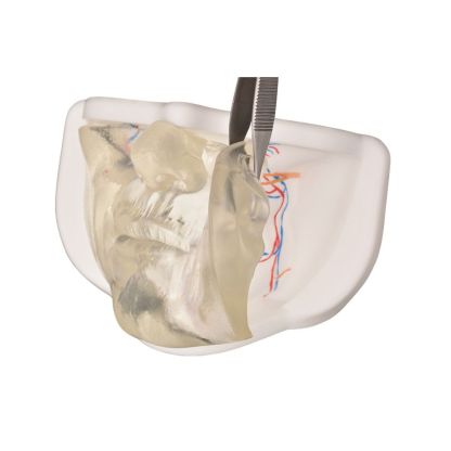 Transparent Lower Facial Injection & Filler Practice Model