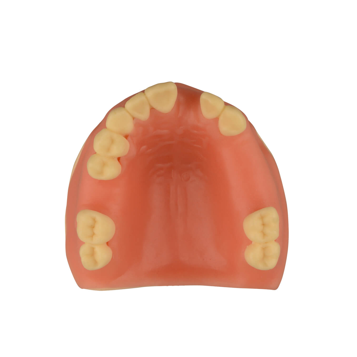 Maxillary Dental Implant Model Missing Partial Teeth 15, 21, 14