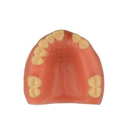 Maxillary Dental Implant Model Missing Partial Teeth 15, 21, 14