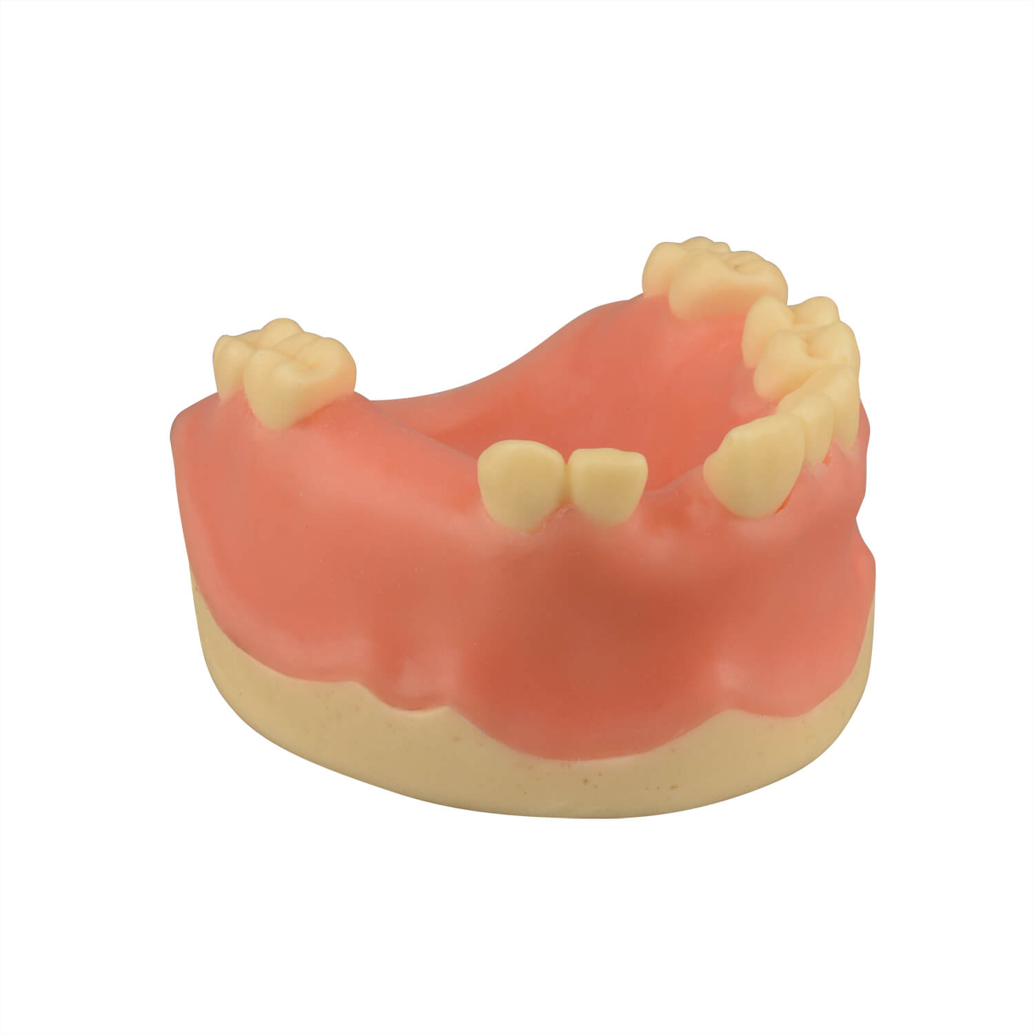 Maxillary Dental Implant Model Missing Partial Teeth 15, 21, 14