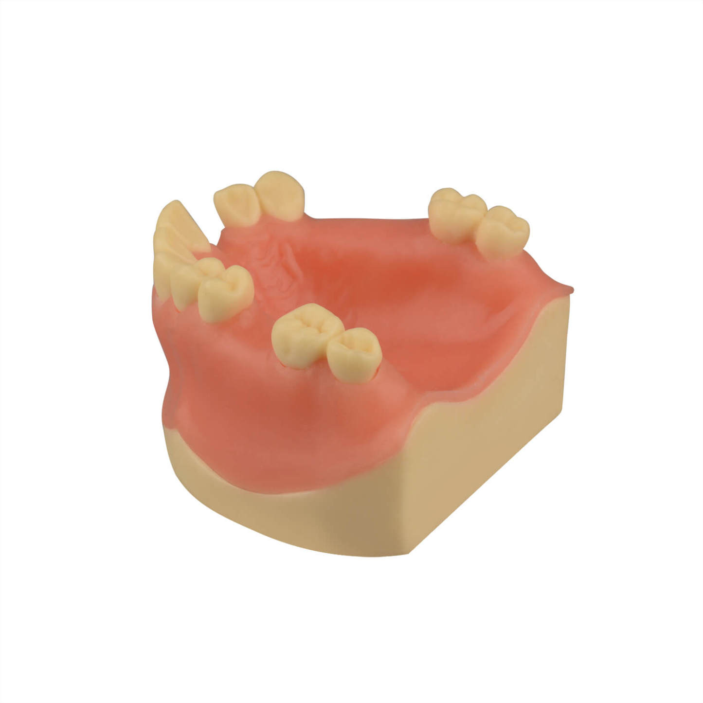 Maxillary Dental Implant Model Missing Partial Teeth 15, 21, 14