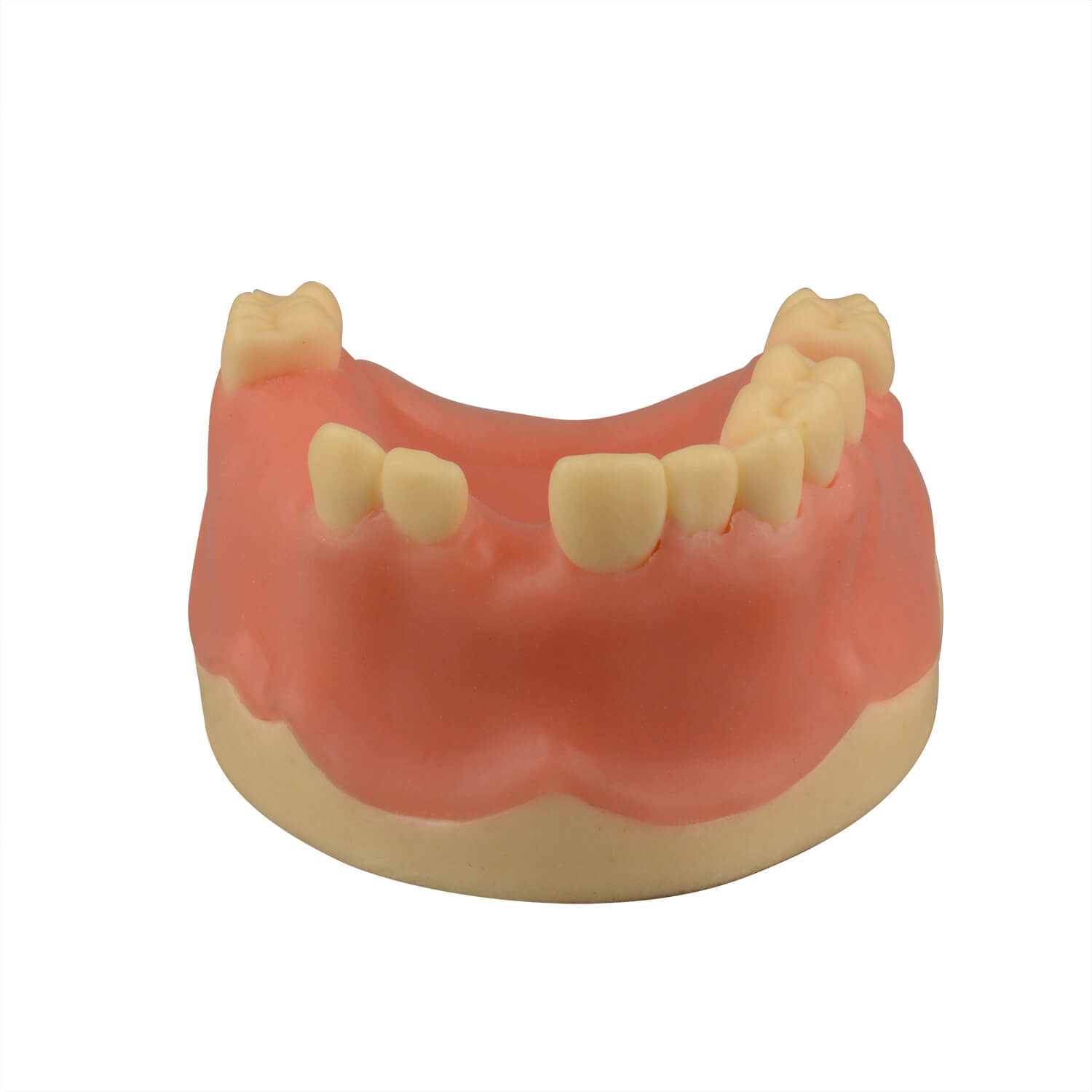 Maxillary Dental Implant Model Missing Partial Teeth 15, 21, 14