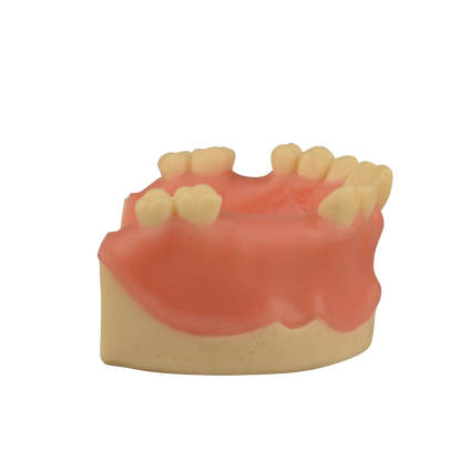 Maxillary Dental Implant Model Missing Partial Teeth 15, 21, 14