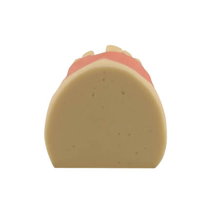 Maxillary Dental Implant Model Missing Partial Teeth 15, 21, 14