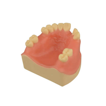 Maxillary Dental Implant Model Missing Partial Teeth 15, 21, 14