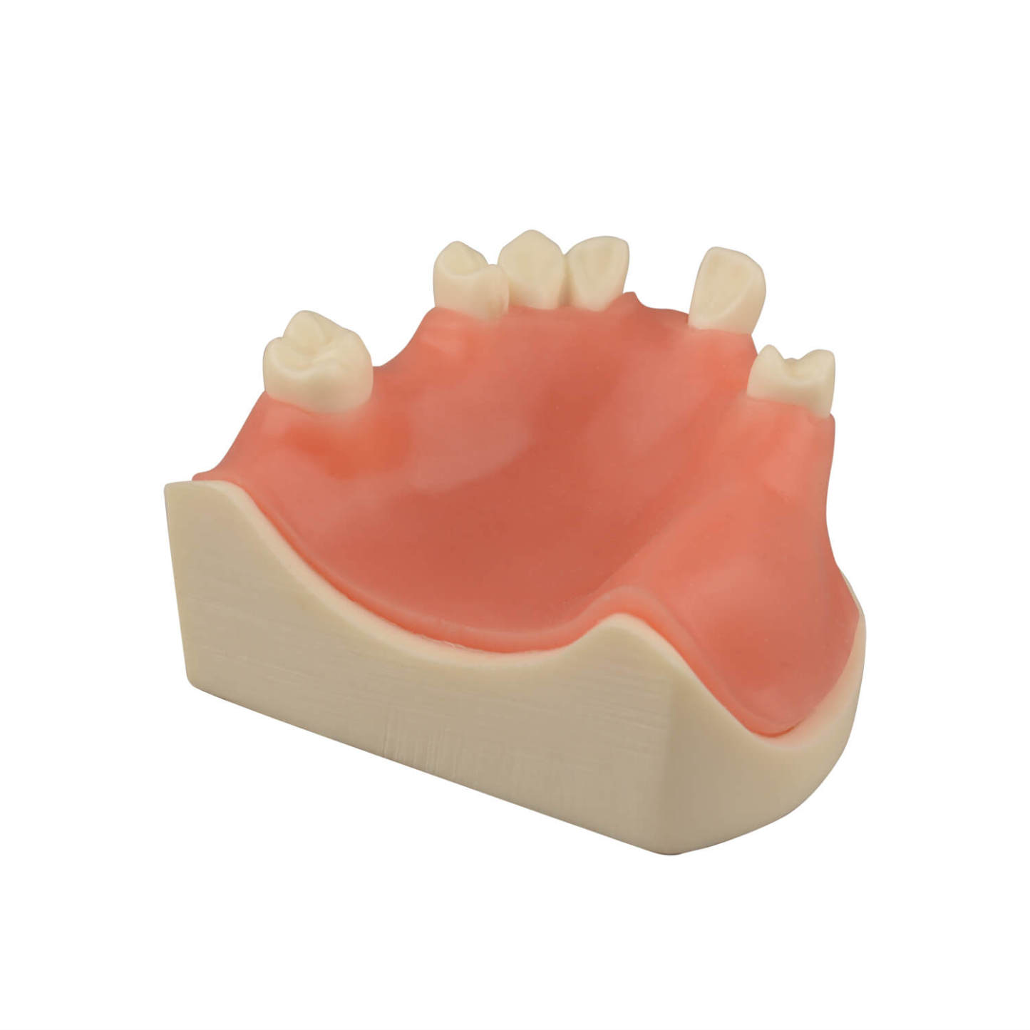 Maxillary Dental Implant Model with Practice Soft Gums, 1:1 Scale