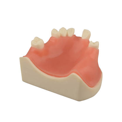 Maxillary Dental Implant Model with Practice Soft Gums, 1:1 Scale