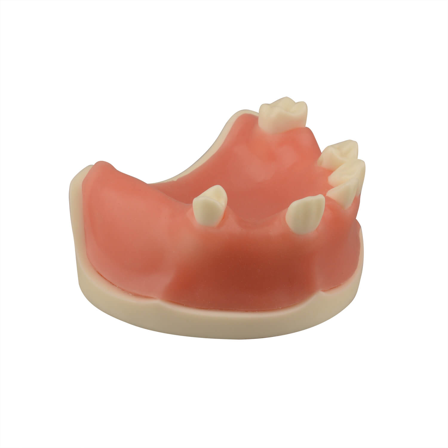 Maxillary Dental Implant Model with Practice Soft Gums, 1:1 Scale