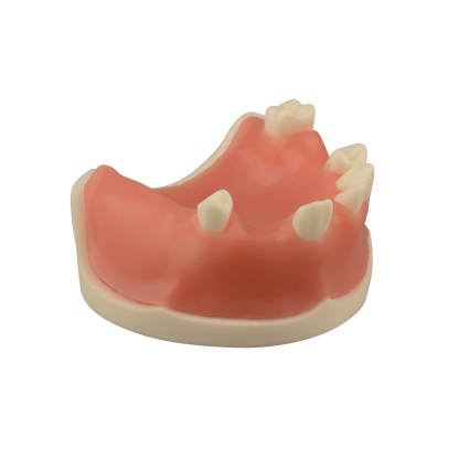 Maxillary Dental Implant Model with Practice Soft Gums, 1:1 Scale