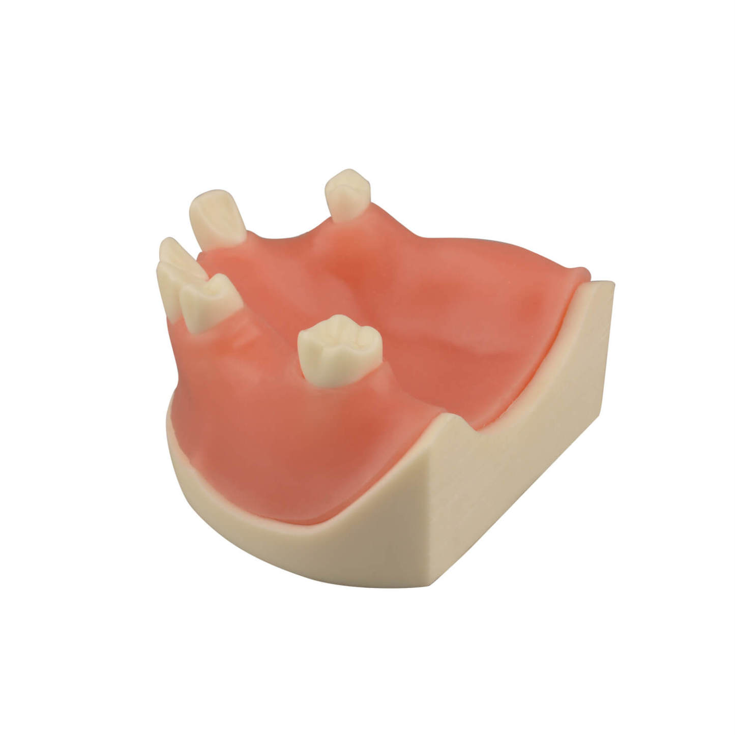 Maxillary Dental Implant Model with Practice Soft Gums, 1:1 Scale