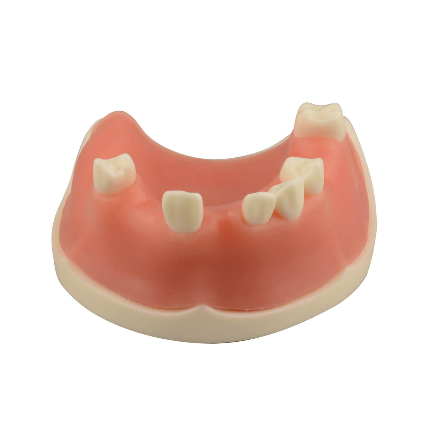 Maxillary Dental Implant Model with Practice Soft Gums, 1:1 Scale