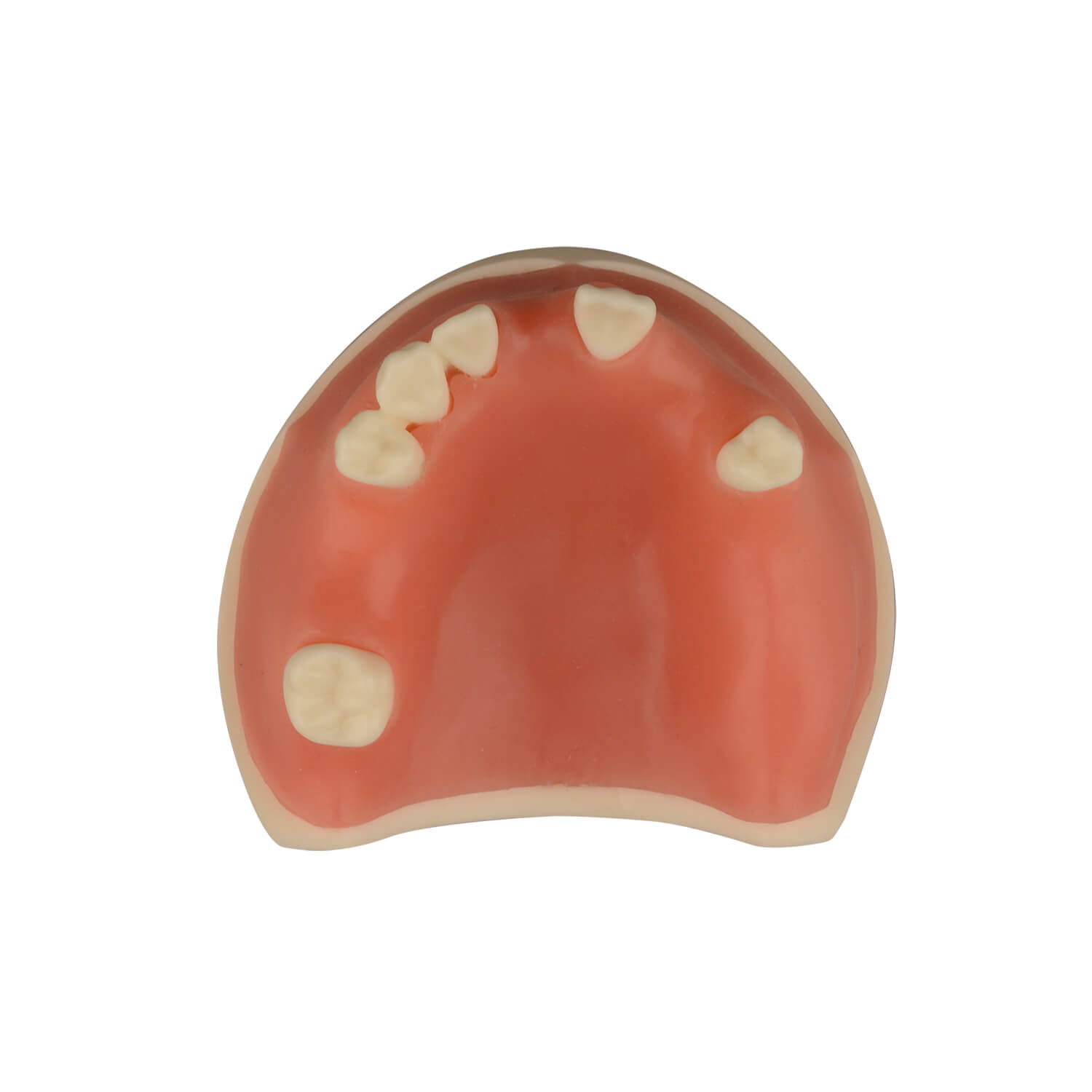 Maxillary Dental Implant Model with Practice Soft Gums, 1:1 Scale