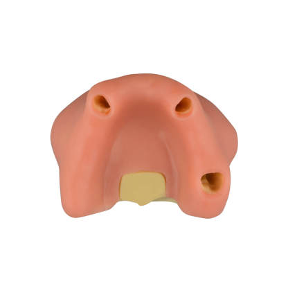 Maxillary Sinus Lift & Implant Practice Model - Type A